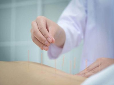 How Does Acupuncture Work for Fertility