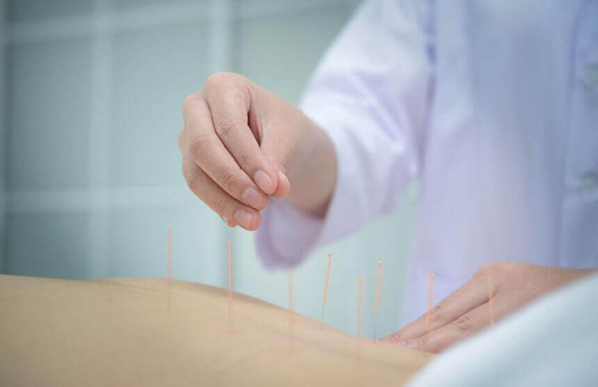 How Does Acupuncture Work for Fertility Hegde Fertility