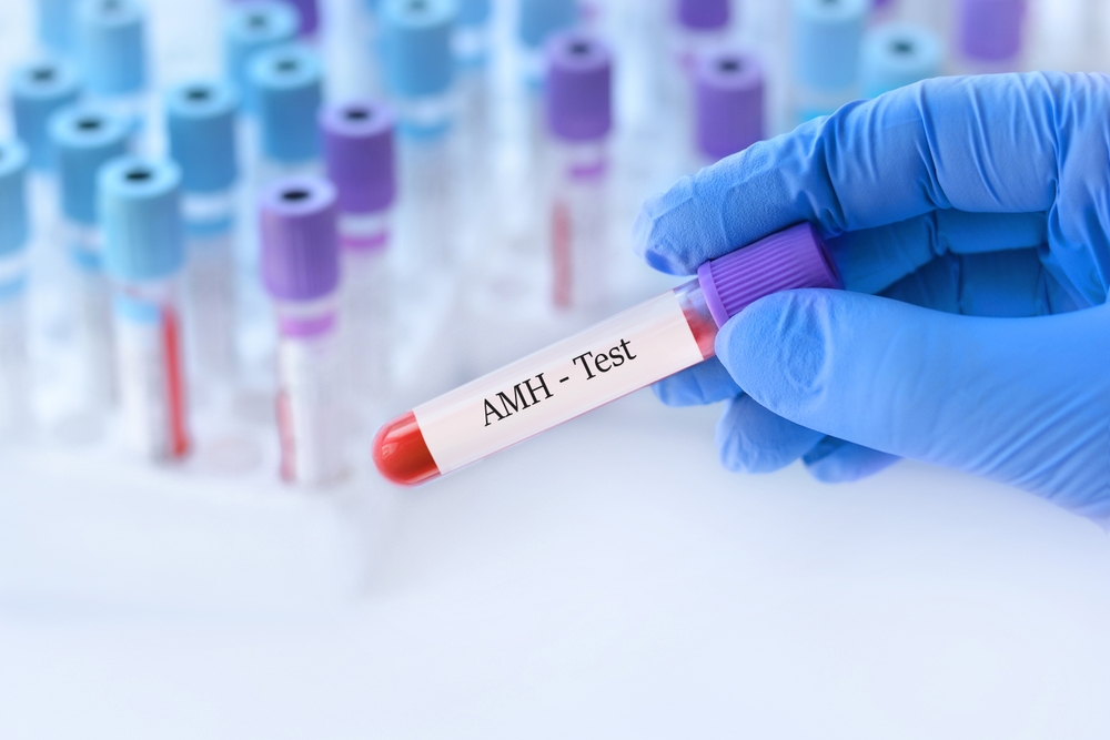 Understanding the Anti-Müllerian Hormone Test: A Key to Fertility Insight