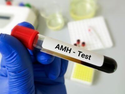 AMH Test