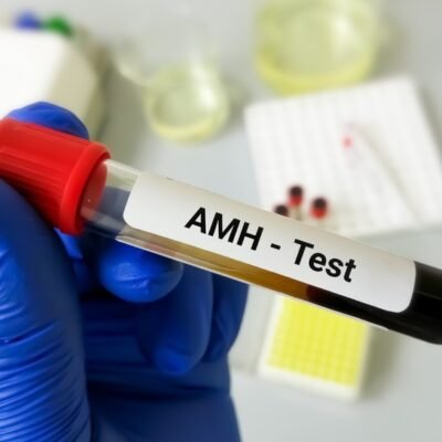 AMH Test