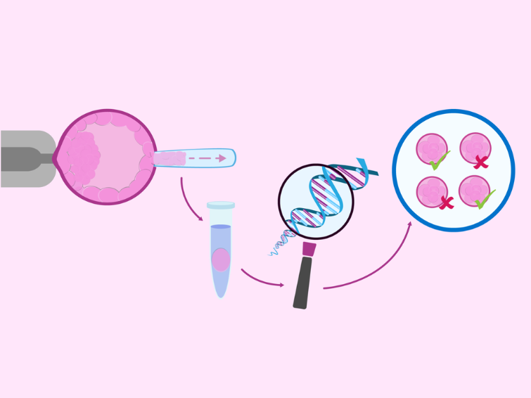 Advanced Genetic Testing in IVF: When to Consider PGT and PGD