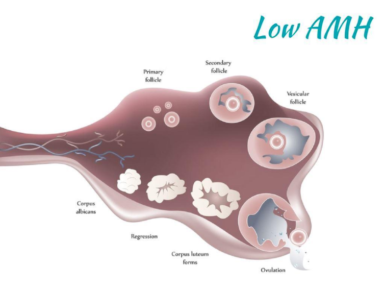 What Does Low Threshold Mean at Lottie Solis blog