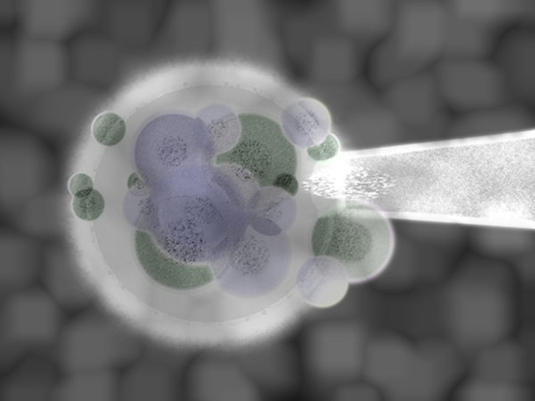 PGT vs PGD: What’s the Difference and Which is Right for You?