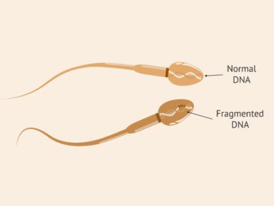 DNA Fragmentation Index