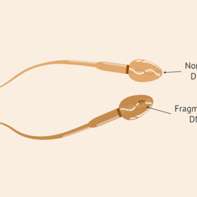 DNA Fragmentation Index