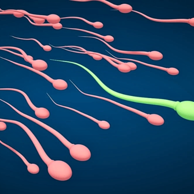 Semen Analysis