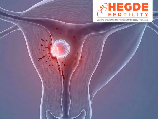 Implantation Bleeding Hegde Fertility