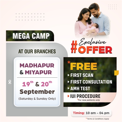 Offer Mobile