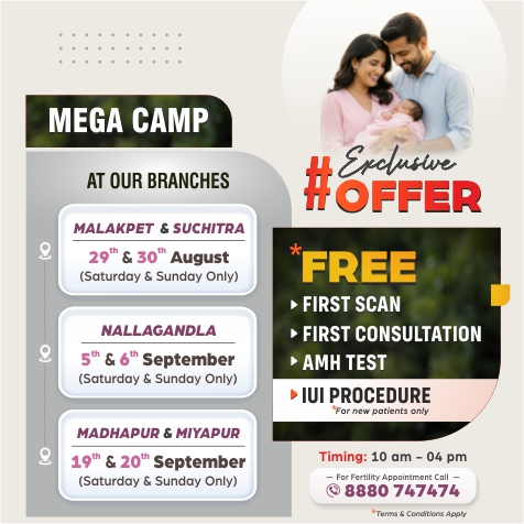 Offer Mobile