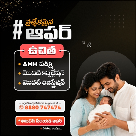Offer Mobile