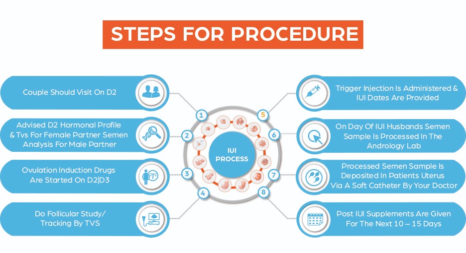iui step by step procedure