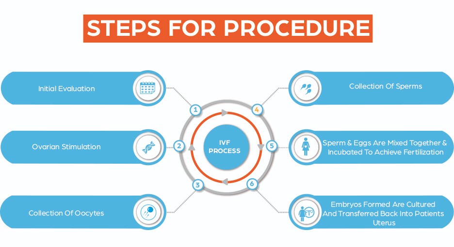 IVF Procedure Step by Step Image