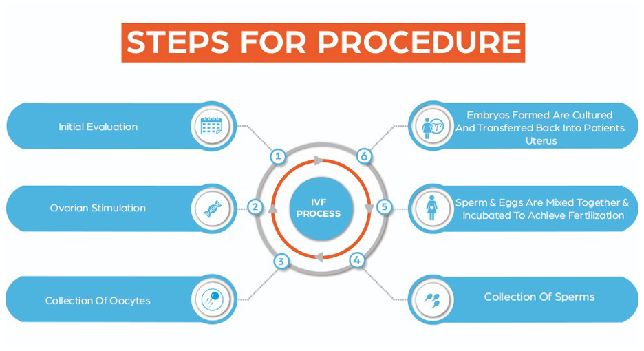 IVF Procedure Step by Step Image
