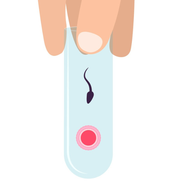 IVF for advanced maternal age